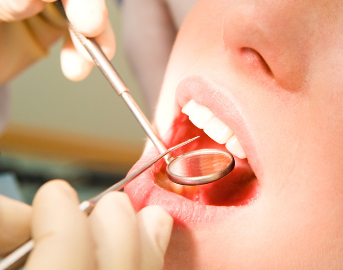 The Most Common Types of General Dentistry in DC