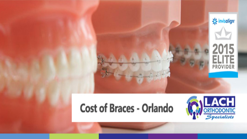 The Perfect Smile: The Cost Of Braces