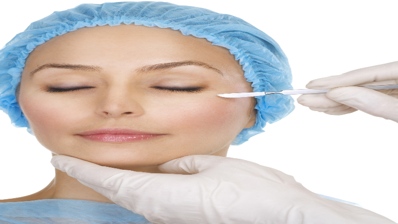 What Are Your Facial Surgery Options