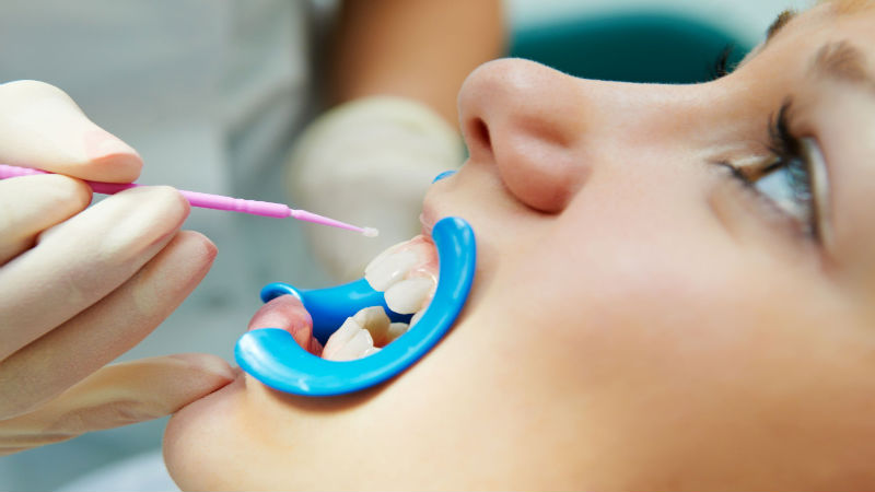 Visit A Dentist In Pewaukee WI Regularly For Outstanding Oral Health