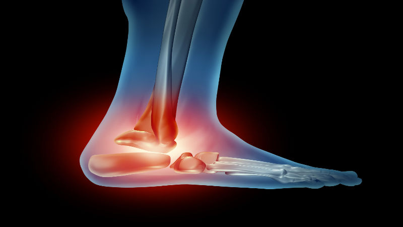 Heel Pain Treatment Options And Considerations