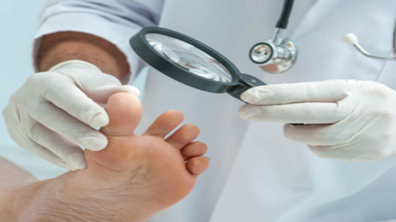 Foot Specialists in Racine WI Help Patients With Poor Circulation Heal Stubborn Foot Sores