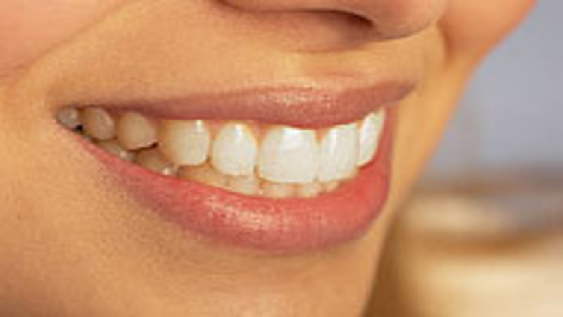 Cosmetic Dentistry in Kalamazoo, MI- What is Cosmetic Dentistry?