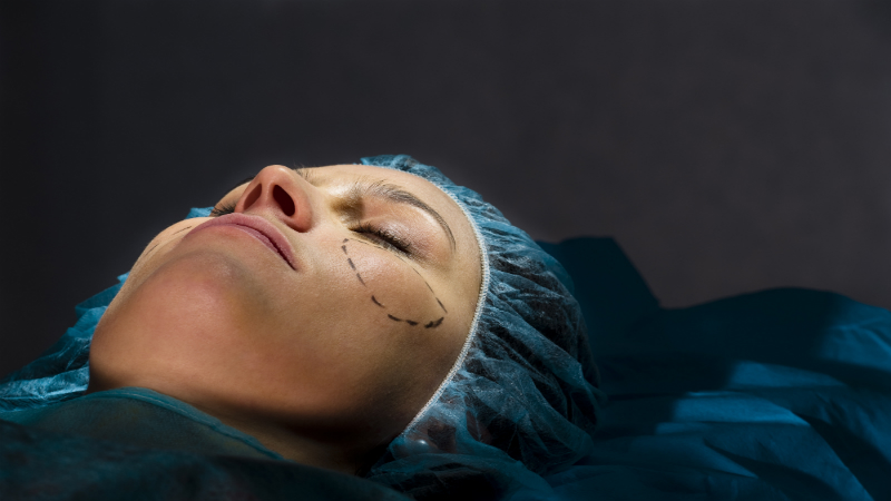 How To Find The Best Photofacials In Chicago