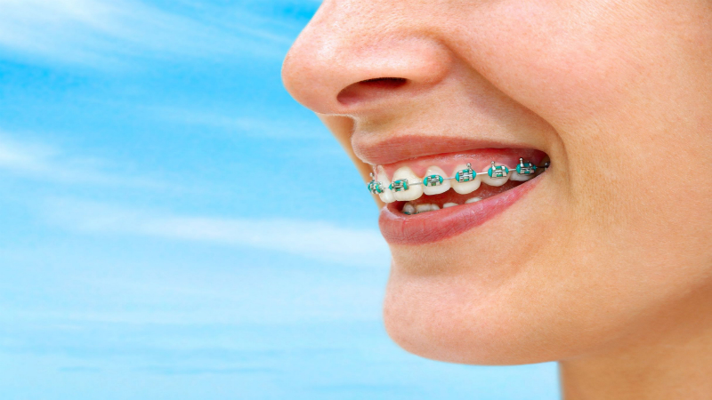 Get a Smile Makeover with Chicago Cosmetic Dentistry Treatments