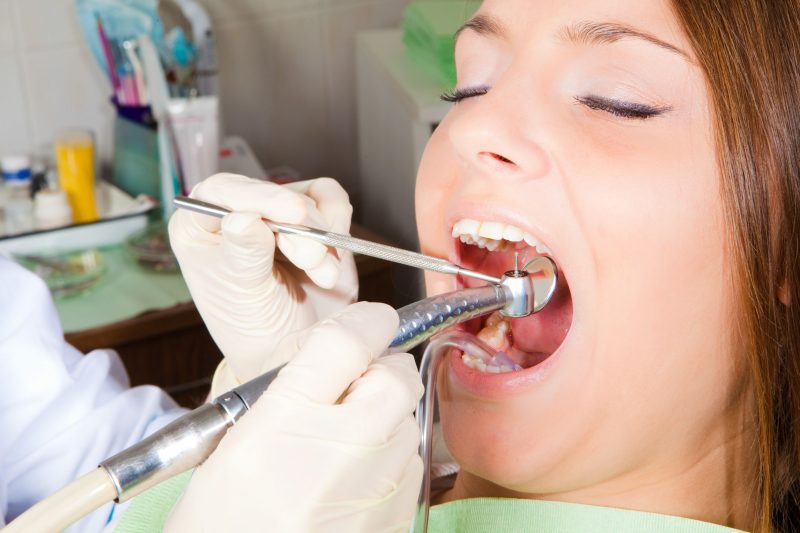 What to Expect When Going to a General Dentist in Alexandria, VA