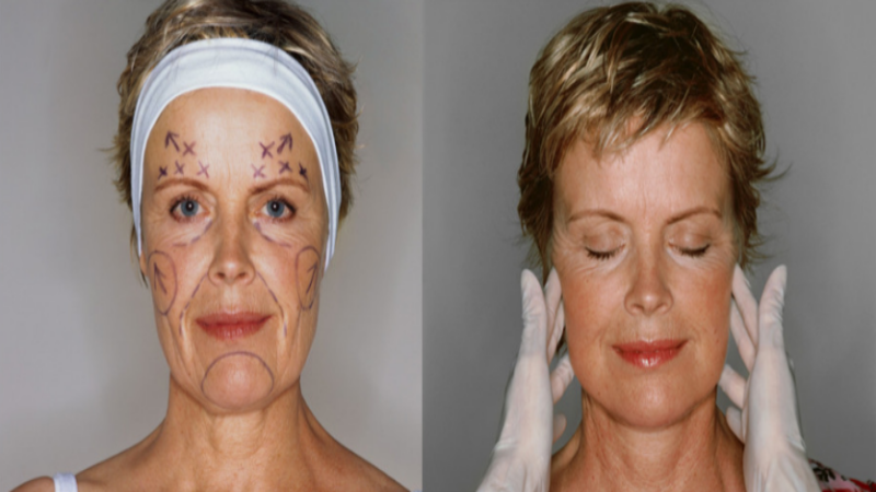 Sculpting in Chevy Chase, MD Could Dramatically Change a Woman’s Appearance